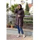 Moda Çizgi Desenli Tunik